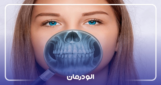 مزایای جراحی فک و صورت در ایران
