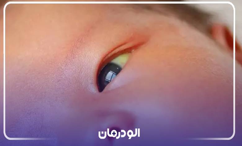 خصوصیات بهترین دکتر زردی در تهران