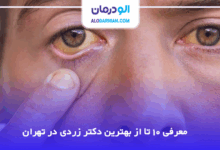 بهترین دکتر زردی در تهران