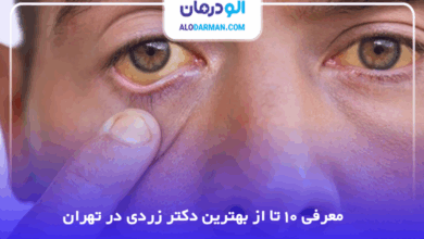 بهترین دکتر زردی در تهران