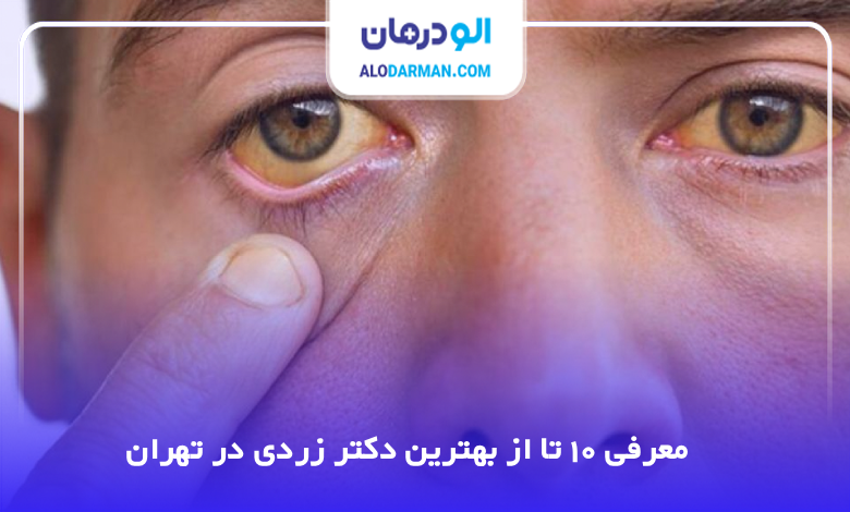 بهترین دکتر زردی در تهران