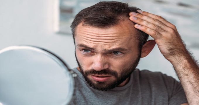 ۷ روش موثر برای درمان ریزش مو