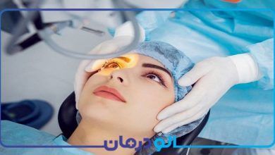 بهترین جراح چشم پزشک آب مروارید در تهران