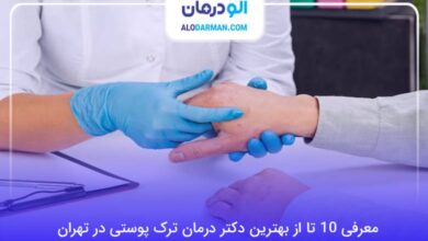 بهترین دکتر درمان ترک پوستی در تهران