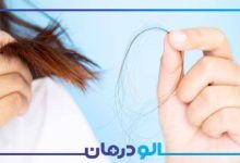 بهترین دکتر ریزش مو در کرج
