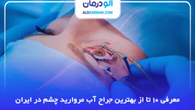 10 تا از بهترین جراح چشم پزشک آب مروارید در ایران