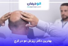 بهترین دکتر ریزش مو در کرج