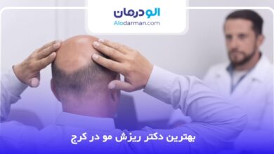 بهترین دکتر ریزش مو در کرج