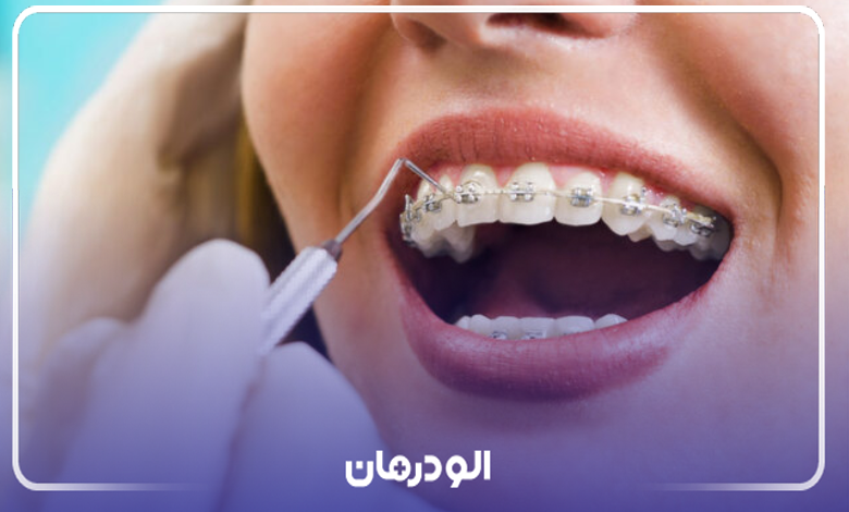 مزایای راجعه به بهترین دکتر رتودنسی دندان